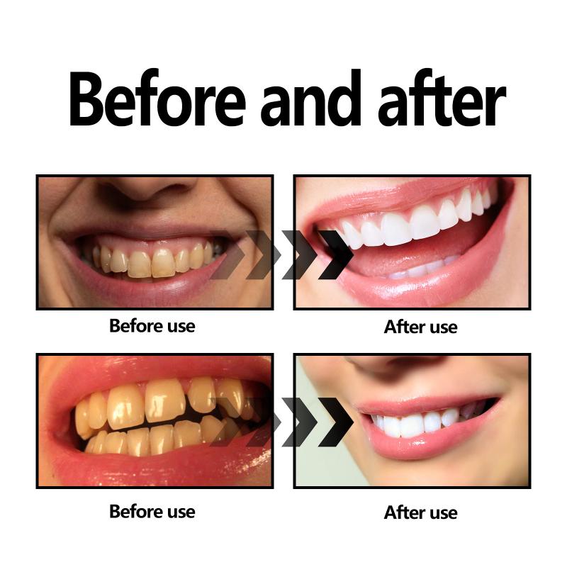 Teeth Whitening Powder Charcoa - Whitening Teeth Using Baking Soda 评论和价格