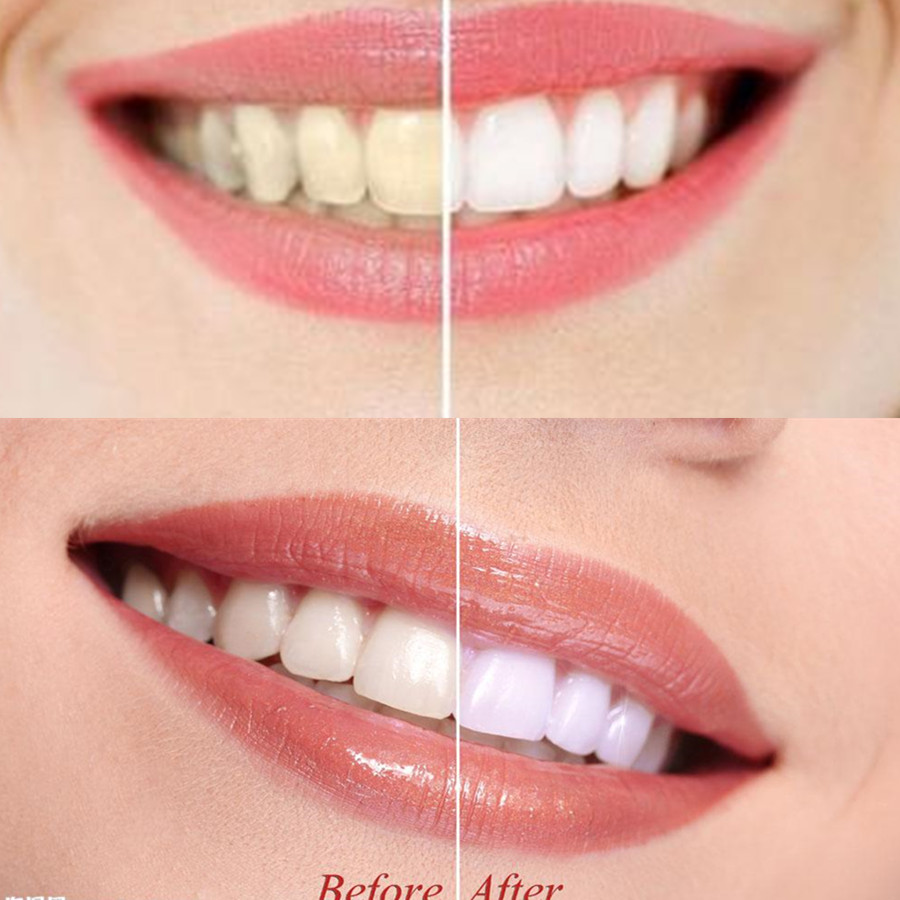 Bamboo Charcoal Teeth Tooth De - Teeth Whitening China 评论和价格