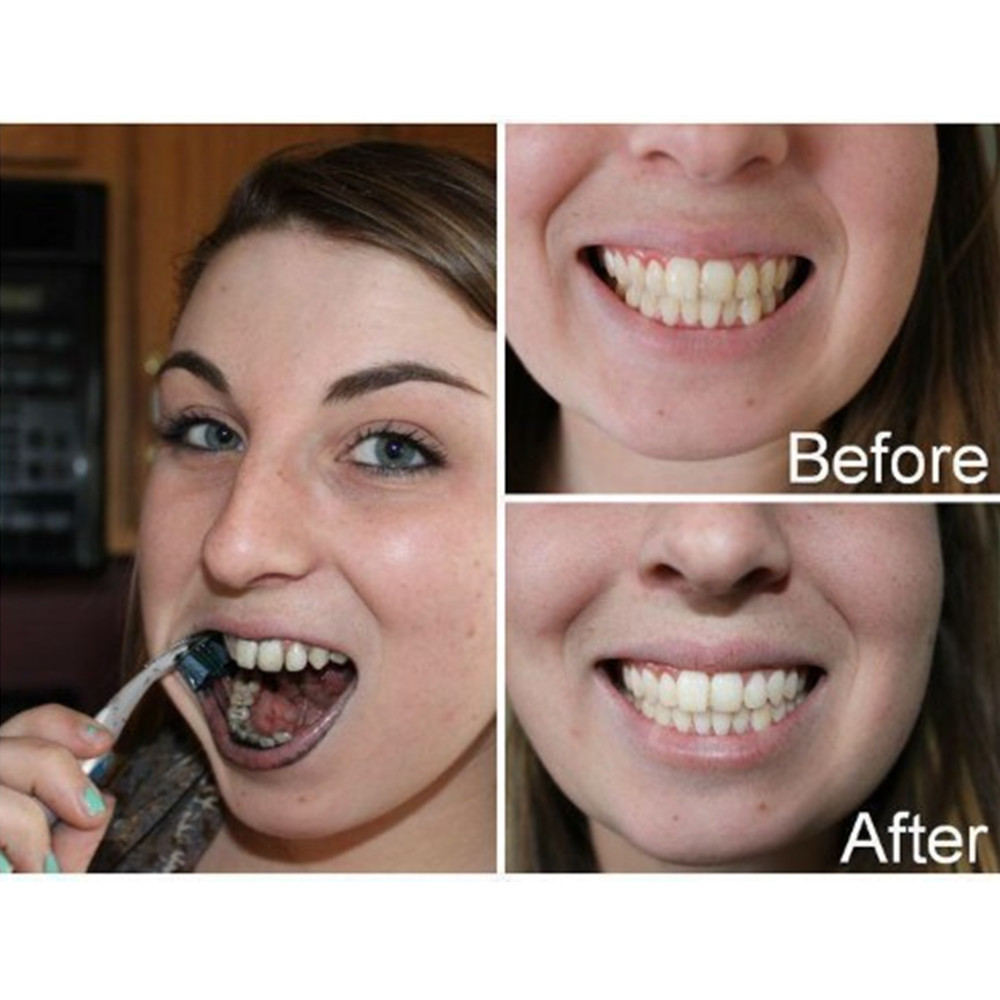 Bamboo Charcoal Teeth Tooth De - Teeth Whitening China 评论和价格