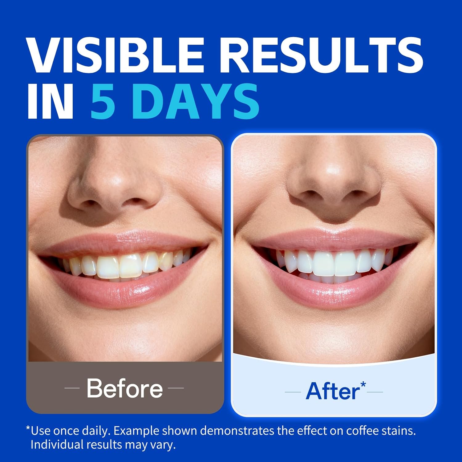 7 pairs Teeth Whitening Strips - Teeth Whitening Strips Crest 评论和价格