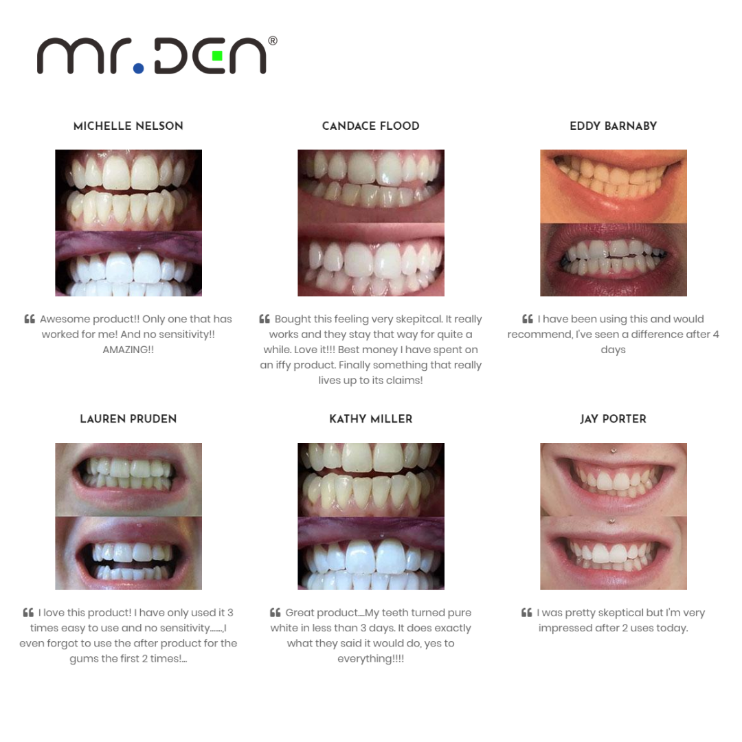 Dr. Whiten 3 Pack Teeth Whiten - Teeth Whitening Usa 评论和价格