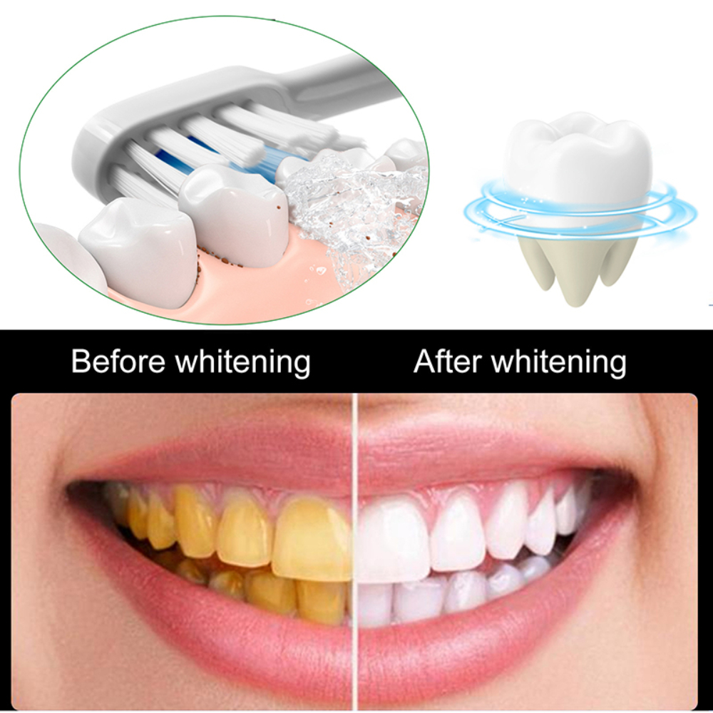 Useful Toothpaste Prevent And  - Whitening Teeth Using Baking Soda 评论和价格