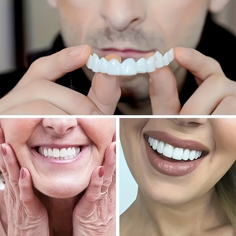 Color Matching Natural Teeth V - Teeth Whitening Options 评论和价格