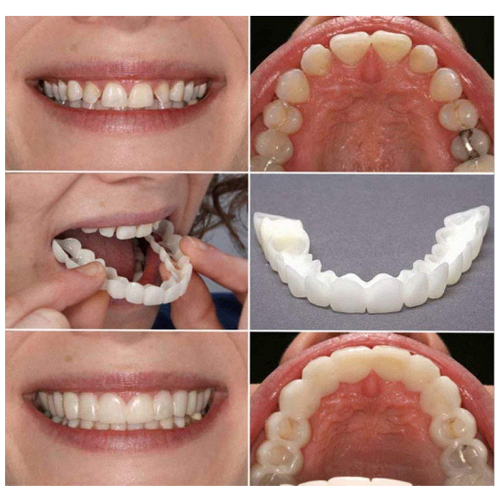 Silicone Denture Set Fit Tempo - Teeth Whitening Usa 评论和价格