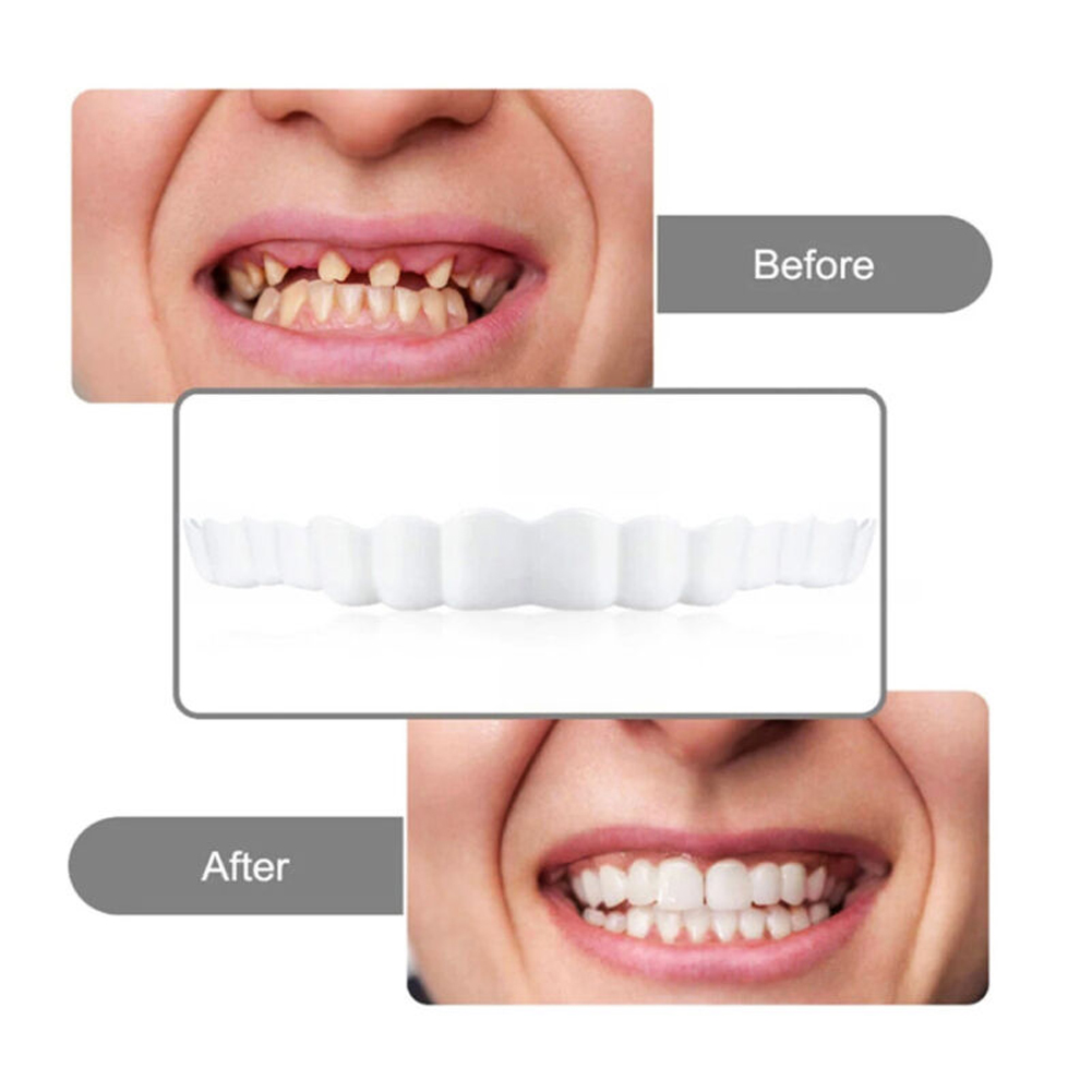 newSilicone Denture Set Fit Te - Teeth Whitening Usa 评论和价格