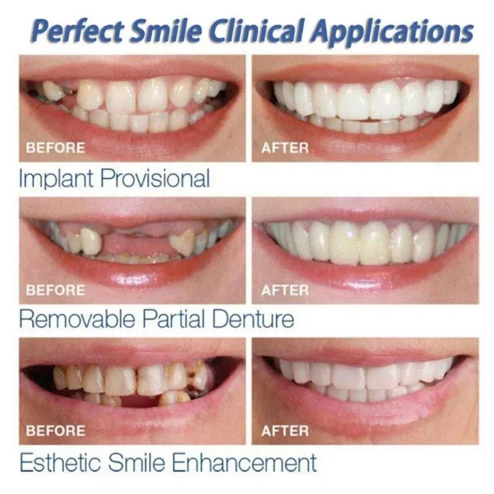 Best Sellers  Teeth Kit Fake T - Teeth Whitening Kit 评论和价格