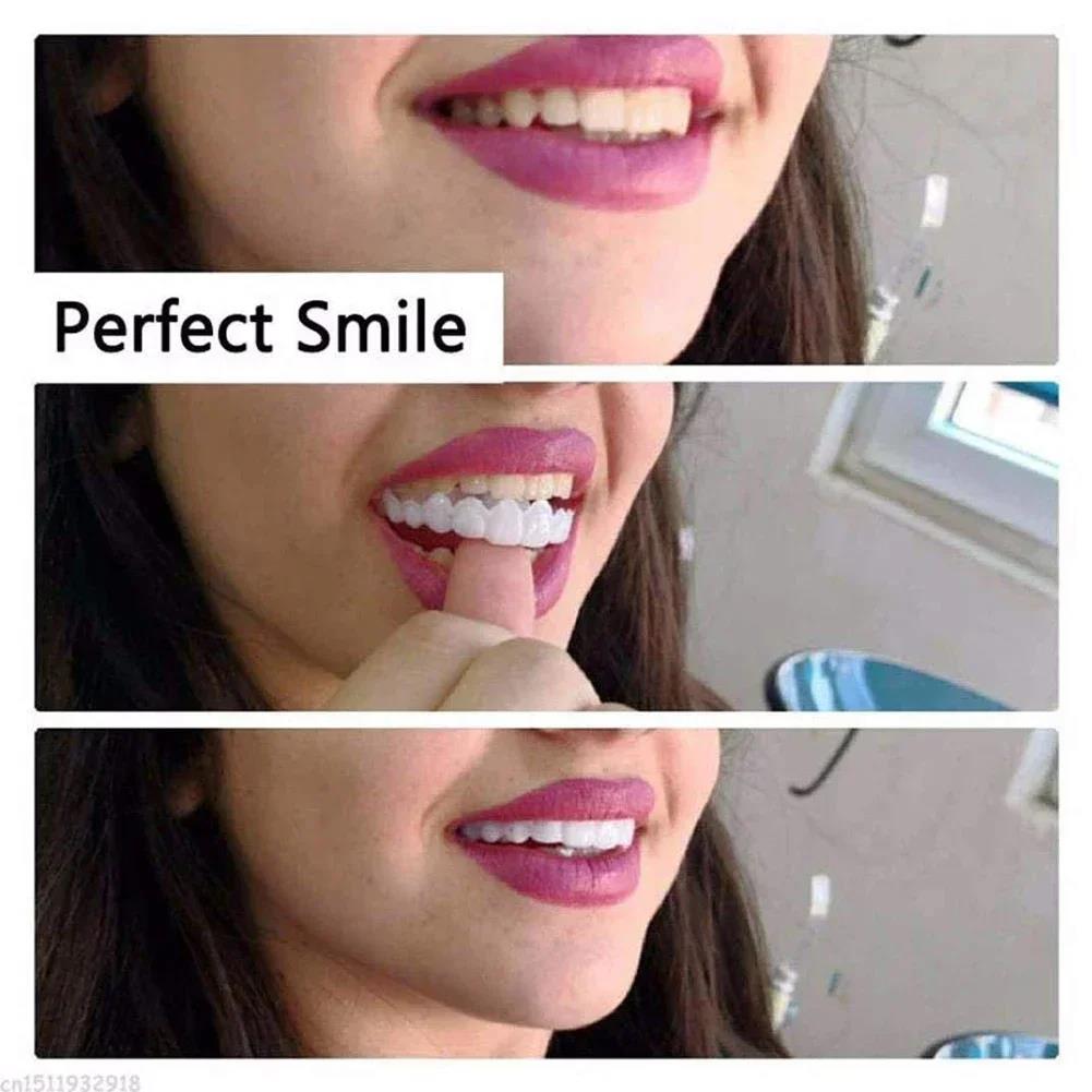 Best Sellers  Teeth Kit Fake T - Teeth Whitening Kit 评论和价格