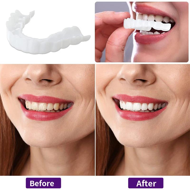 New Color Matching Natural Tee - Teeth Whitening Options 评论和价格