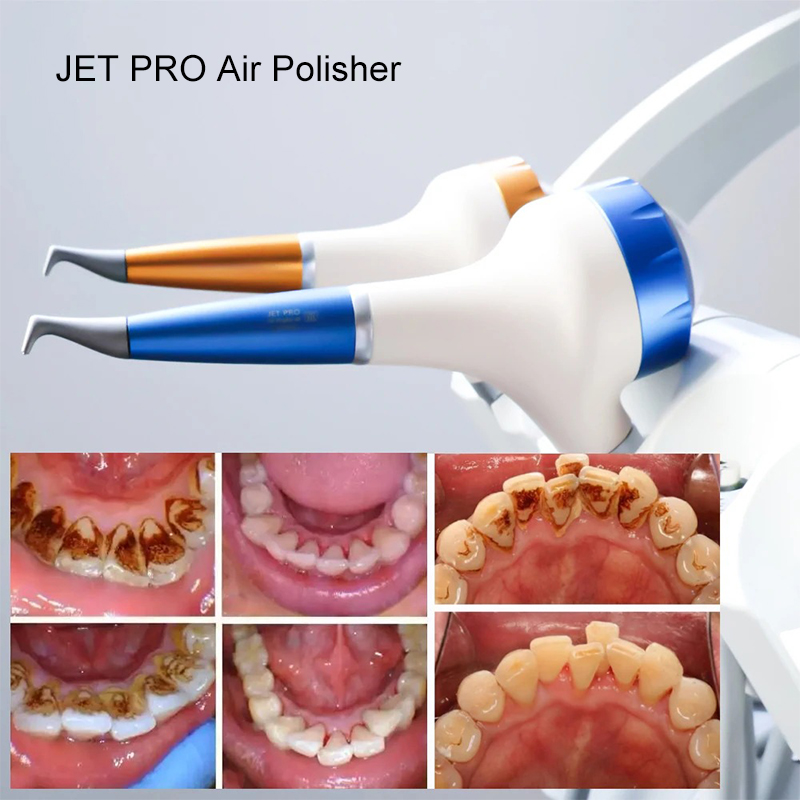 VV Dental  Air Polishing Proph - Teeth Whitening Usa 评论和价格