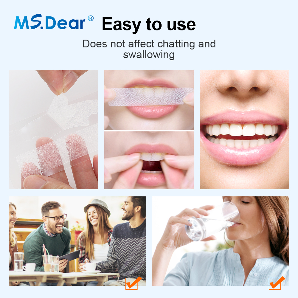 7/14/21/28/70 Pairs 9D Gel Tee - Teeth Whitening Strips Crest 评论和价格
